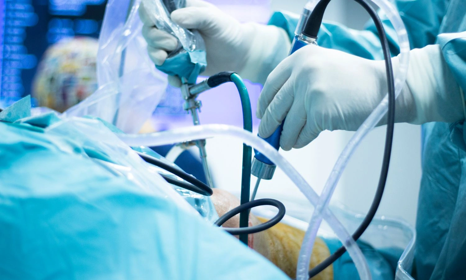 Top Arthroscopic Doctor in Ghaziabad